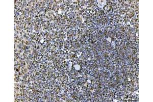 IHC analysis of SAP130 using anti-SAP130 antibody (ABIN7601247). (SAP130 antibody  (AA 309-913))