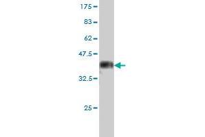 Western Blot detection against Immunogen (37. (STK25 antibody  (AA 321-426))