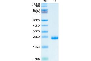 TIMP2 Protein (His tag)