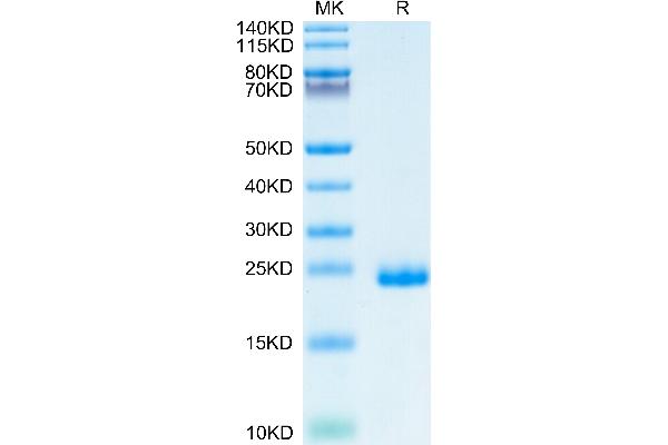 TIMP2 Protein (His tag)