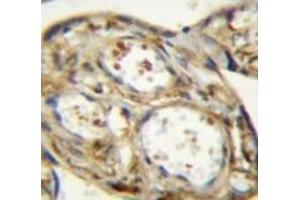 Immunohistochemistry analysis in human placenta tissue (Formalin-fixed, Paraffin-embedded) using DLK1  Antibody , followed by peroxidase conjugated secondary antibody and DAB staining. (DLK1 antibody)