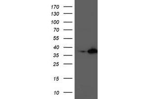 HEK293T cells were transfected with the pCMV6-ENTRY control (Left lane) or pCMV6-ENTRY NUDT18 (Right lane) cDNA for 48 hrs and lysed. (NUDT18 antibody)