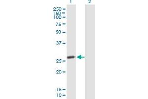 Western Blot analysis of IDI2 expression in transfected 293T cell line by IDI2 MaxPab polyclonal antibody. (IPP Isomerase 2 antibody  (AA 1-227))