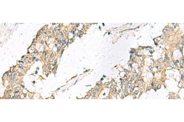 MGAT4B antibody