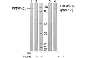 Image no. 1 for anti-Protein Kinase D1 (PRKD1) (Ser738) antibody (ABIN197313) (PKC mu antibody  (Ser738))