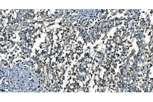 IHC analysis of CDC45L using anti-CDC45L antibody (ABIN7600230). (CDC45 antibody  (AA 166-431))