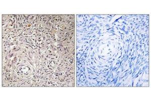 Immunohistochemistry analysis of paraffin-embedded human ovary tissue using GCNT7 antibody. (GCNT7 antibody  (C-Term))