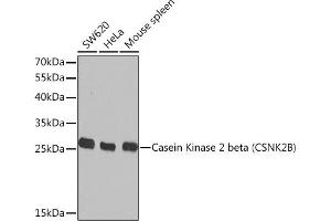 Western blot analysis of extracts of various cell lines, using Casein Kinase 2 beta (Casein Kinase 2 beta (CSNK2B)) Rabbit pAb  at 1:1000 dilution. (CSNK2B antibody  (AA 1-215))