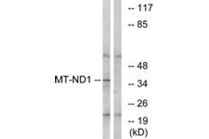 Western blot analysis of extracts from Jurkat cells, using MT-ND1 Antibody. (MT-ND1 antibody  (AA 176-225))