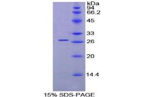 SDS-PAGE (SDS) image for Malectin (MLEC) (AA 22-254) protein (His tag) (ABIN1099272) (Malectin Protein (MLEC) (AA 22-254) (His tag))