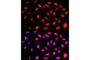 Immunofluorescence analysis of U-2 OS cells using VCP Rabbit mAb (ABIN7271284) at dilution of 1:100 (40x lens). (VCP antibody)