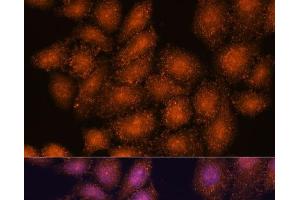 Immunofluorescence analysis of HeLa cells using SMYD3 Polyclonal Antibody at dilution of 1:100. (SMYD3 antibody)