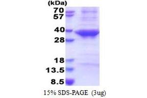 SDS-PAGE (SDS) image for Cathepsin E (CTSE) (AA 57-363) protein (His tag) (ABIN5853580)