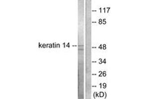 Western blot analysis of extracts from NIH-3T3 cells, using Keratin 14 Antibody. (KRT14 antibody  (AA 1-50))
