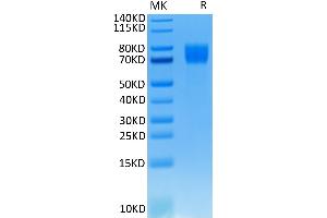 Human FGFR1 alpha (IIIc) on Tris-Bis PAGE under reduced conditions. (FGFR1 Protein (AA 22-374) (His-Avi Tag))