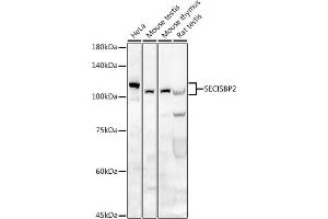 Western blot analysis of extracts of various cell lines, using SECISBP2 antibody (ABIN6128699, ABIN6147497, ABIN6147498 and ABIN6222461) at 1:500 dilution.