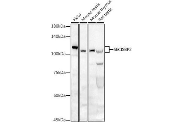 SECISBP2 抗体  (AA 585-854)