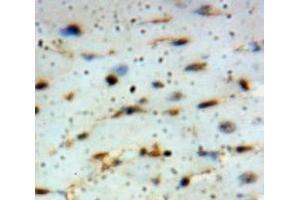 Used in DAB staining on fromalin fixed paraffin-embedded Heart tissue (ADIPOQ antibody  (AA 108-244))