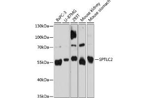 Western blot analysis of extracts of various cell lines, using SPTLC2 Antibody (ABIN6132682, ABIN6148411, ABIN6148412 and ABIN6215412) at 1:3000 dilution. (SPTLC2 antibody  (AA 423-562))