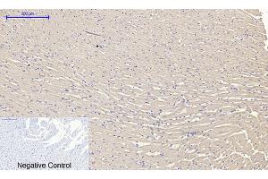Immunohistochemical analysis of paraffin-embedded rat heart tissue. (RANKL antibody  (AA 10-90))