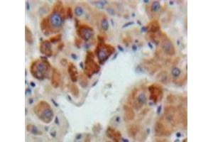 IHC-P analysis of Liver tissue, with DAB staining. (Hepcidin antibody  (AA 24-83))