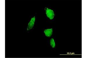 Immunofluorescence of purified MaxPab antibody to PSMA6 on HeLa cell. (PSMA6 antibody  (AA 1-246))
