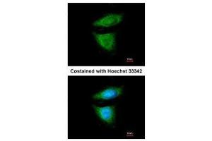 ICC/IF Image Immunofluorescence analysis of methanol-fixed HeLa, using DYNC1I2, antibody at 1:200 dilution. (DYNC1I2 antibody)