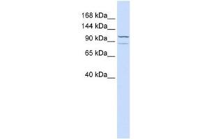 ADCY6 antibody used at 1 ug/ml to detect target protein.