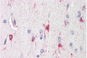 ABIN1686794 (5µg/ml) staining of paraffin embedded Human Cortex. (BAG3 antibody  (Internal Region))