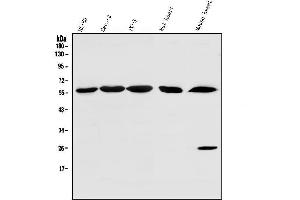 Western blot analysis of SRP1/KPNA1 using anti-SRP1/KPNA1 antibody (ABIN7603189).