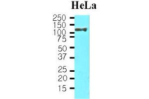 Western blot analysis: Cell lysates of HeLa(30ug) were resolved by SDS-PAGE, transferred to NC membrane and probed with anti-human HSP105 ? (HSPH1 antibody)