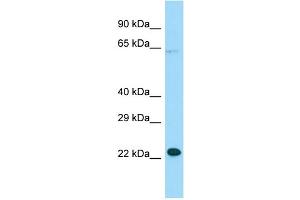 MOSPD1 抗体  (N-Term)