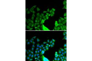 Immunofluorescence analysis of HeLa cells using BCL2L14 antibody (ABIN5973873). (BCL2L14 antibody)