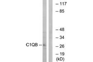 Western blot analysis of extracts from Jurkat cells, using C1QB Antibody. (C1QB antibody  (AA 161-210))