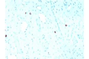 IHC staining of FFPE human cervix with recombinant HPV16 L1 antibody (clone rHPV16L1/1058). (Human Papilloma Virus 16 Capsid Protein (HPV-16 L1) antibody)