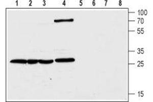 Western blot analysis of human colorectal adenocarcinoma HT-29 (lanes 1 and 5), transplantable human carcinoma cell line T-84 (lanes 2 and 6), human pancreatic carcinoma PANC-1 (lanes 3 and 7) and rat kidney (lanes 4 and 8) lysates: - 1-4.