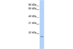 WB Suggested Anti-POLE3 Antibody Titration: 0. (POLE3 antibody  (N-Term))