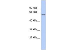 WB Suggested Anti-PDE4B Antibody Titration: 0. (PDE4B antibody  (Middle Region))