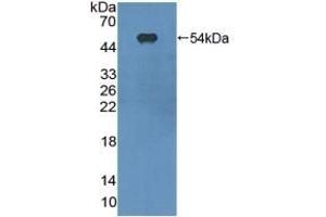 Detection of Recombinant ITGaX, Mouse using Polyclonal Antibody to Integrin Alpha X (CD11c) (CD11c antibody  (AA 907-1115))