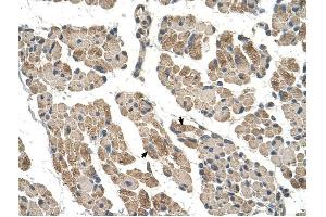 CLCC1 antibody was used for immunohistochemistry at a concentration of 4-8 ug/ml to stain Skeletal muscle cells (arrows) in Human Muscle.