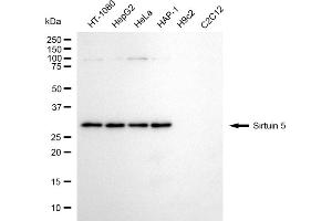 Western blotting analysis using sirtuin 5 antibody (ABIN7800355). (SIRT5 antibody)