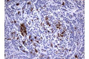 Image no. 1 for anti-Thymidylate Synthetase (TYMS) antibody (ABIN1501589) (TYMS antibody)