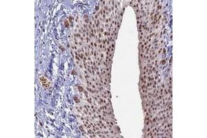 Immunohistochemical staining of human urinary bladder with MFAP1 polyclonal antibody  shows moderate nuclear positivity in urothelial cells at 1:2500-1:5000 dilution.