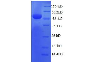 Ribosomal Protein L8 (RPL8) (AA 3-257), (partial) protein (GST tag)