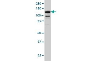 DAAM1 monoclonal antibody (M05), clone 5D3 Western Blot analysis of DAAM1 expression in A-431 . (DAAM1 antibody  (AA 1-110))