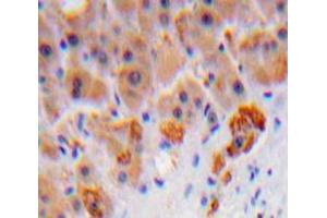 IHC-P analysis of Liver tissue, with DAB staining. (C8B antibody  (AA 162-504))