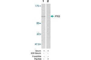 Western blot analysis of extracts from HeLa using PTK2 polyclonal antibody . (FAK antibody)