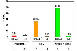 ChIP results obtained with the Histone H3 (K9me2) polyclonal antibody . (Histone 3 antibody  (H3K9me2))