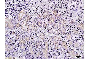 Formalin-fixed and paraffin embedded human stomach tissue labeled with Anti-MACC1Polyclonal Antibody, Unconjugated (ABIN706526) followed by conjugation to the secondary antibody and DAB staining (MACC1 antibody  (AA 761-852))