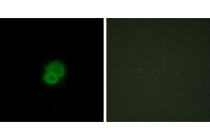 Peptide - +Western blot analysis of extracts from 293 cells, using ARMX2 antibody. (ARMCX2 antibody)